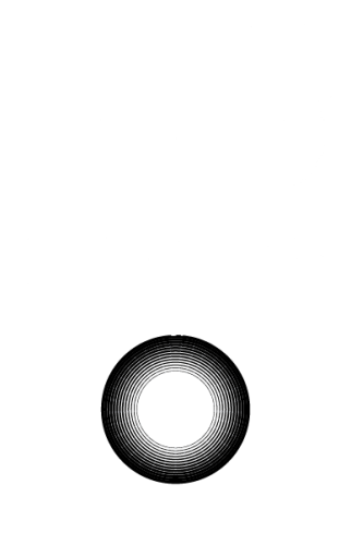 plasma pedal support